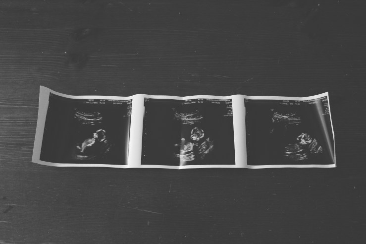 636414454369824569_Afterlight_Edit