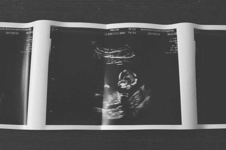 636414454793949283_Afterlight_Edit